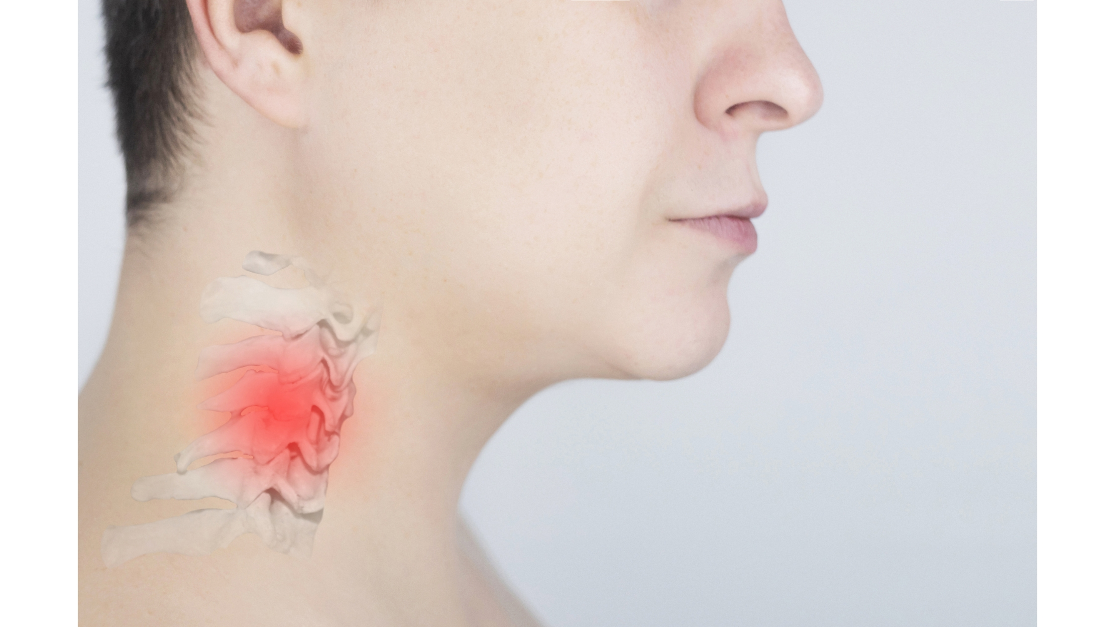 cervical disc PROBLEM