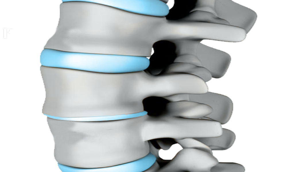 Degenerative Disc Disease Treatment in Dubai